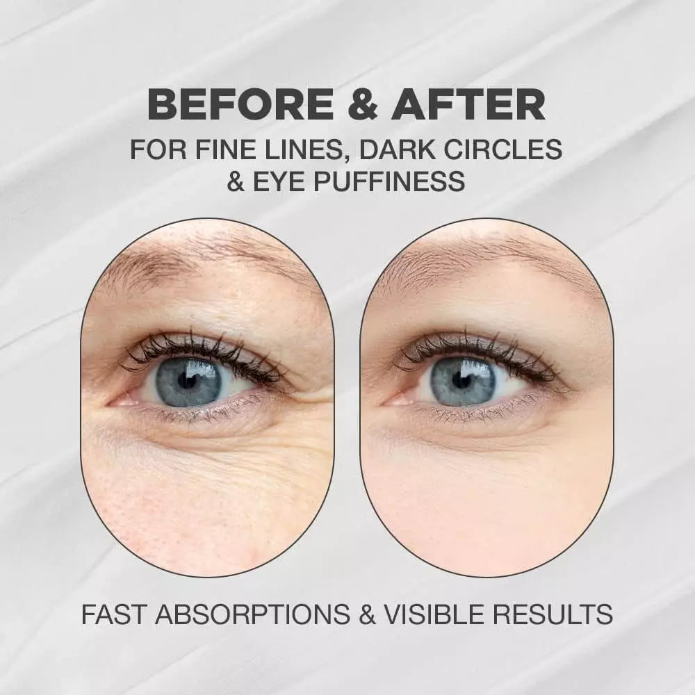 Snail Eye Anti-Wrinkle Eye Cream