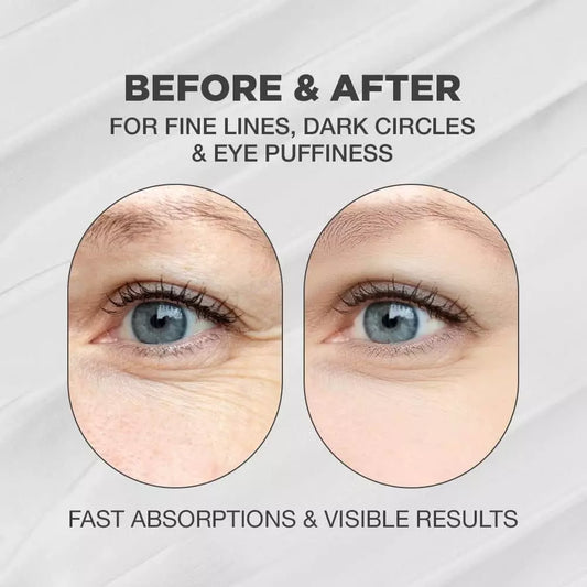 Snail Eye Anti-Wrinkle Eye Cream