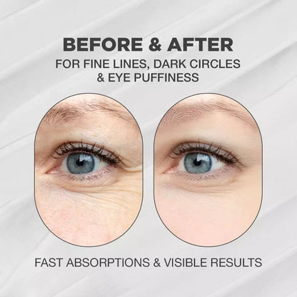 Snail Eye Anti-Wrinkle Eye Cream